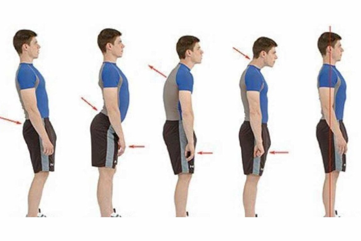 How To Fix Your Posture for Good: Tips, Tricks, & Exercises